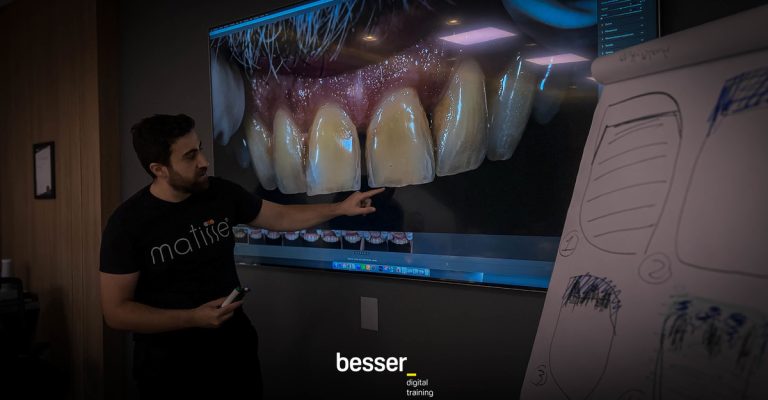 digital_shade_matching_besser_digital_training__13_